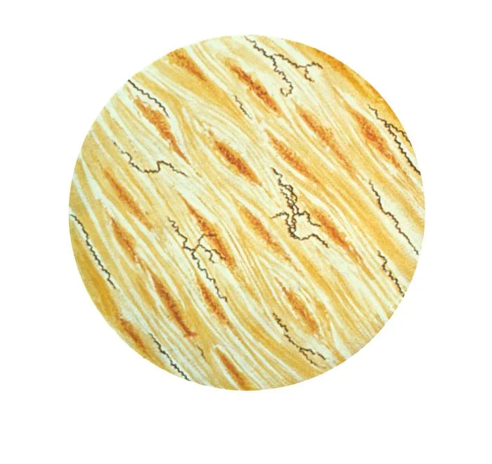 A photomicrograph of thin corkscrew-shaped Treponema pallidum bacteria stained dark against a pale tissue background.