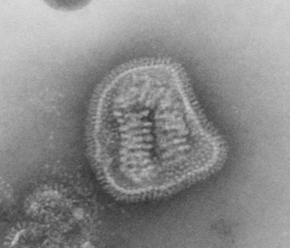 A grayscale transmission-electron micrograph of a single influenza virus particle, its surface bristling with protein spikes, on a clean gray background.