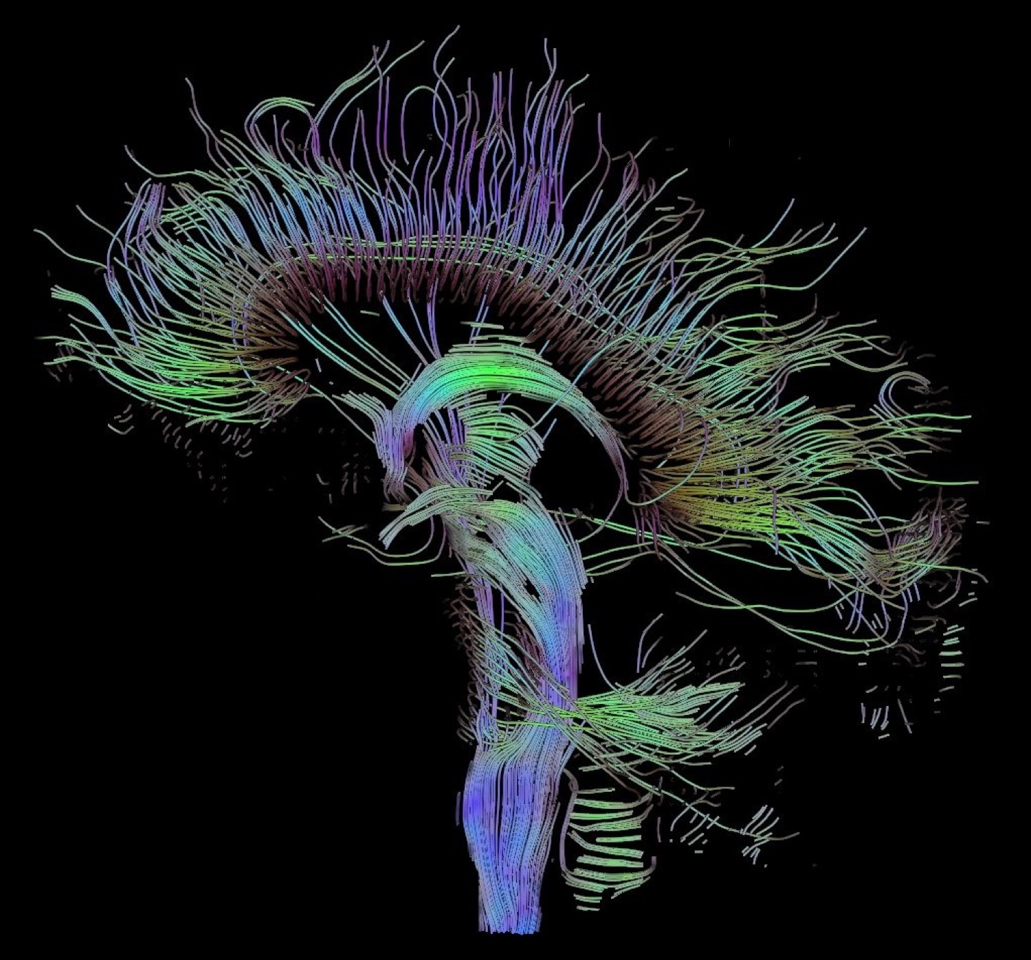Diffusion-tensor tractography of a human brain: thousands of rainbow-coloured neural fibre tracts arcing through the head in profile.